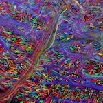 Brainbow